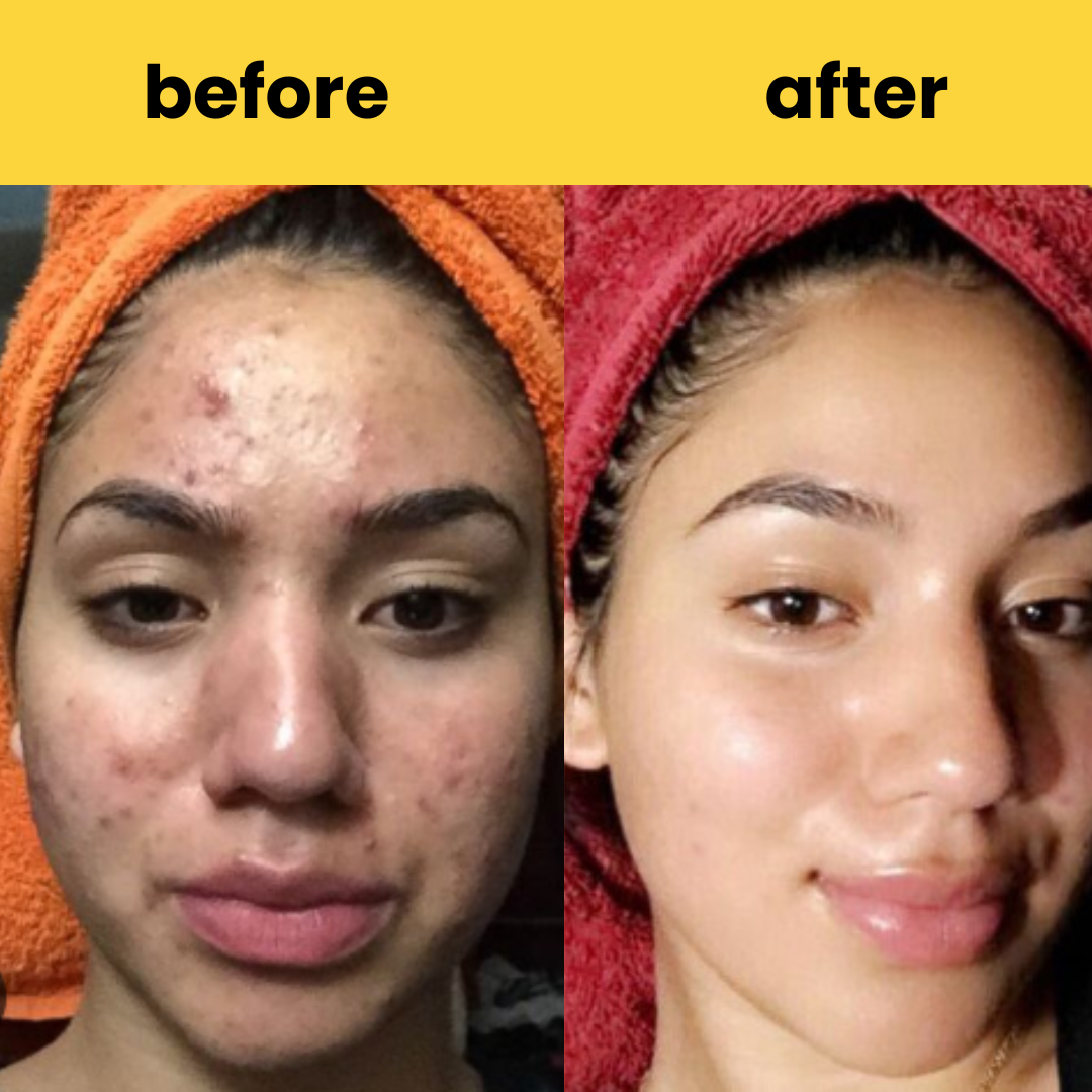HORIZONLUX™ Turmeric Kojic Acid Pads (60 Pads)
