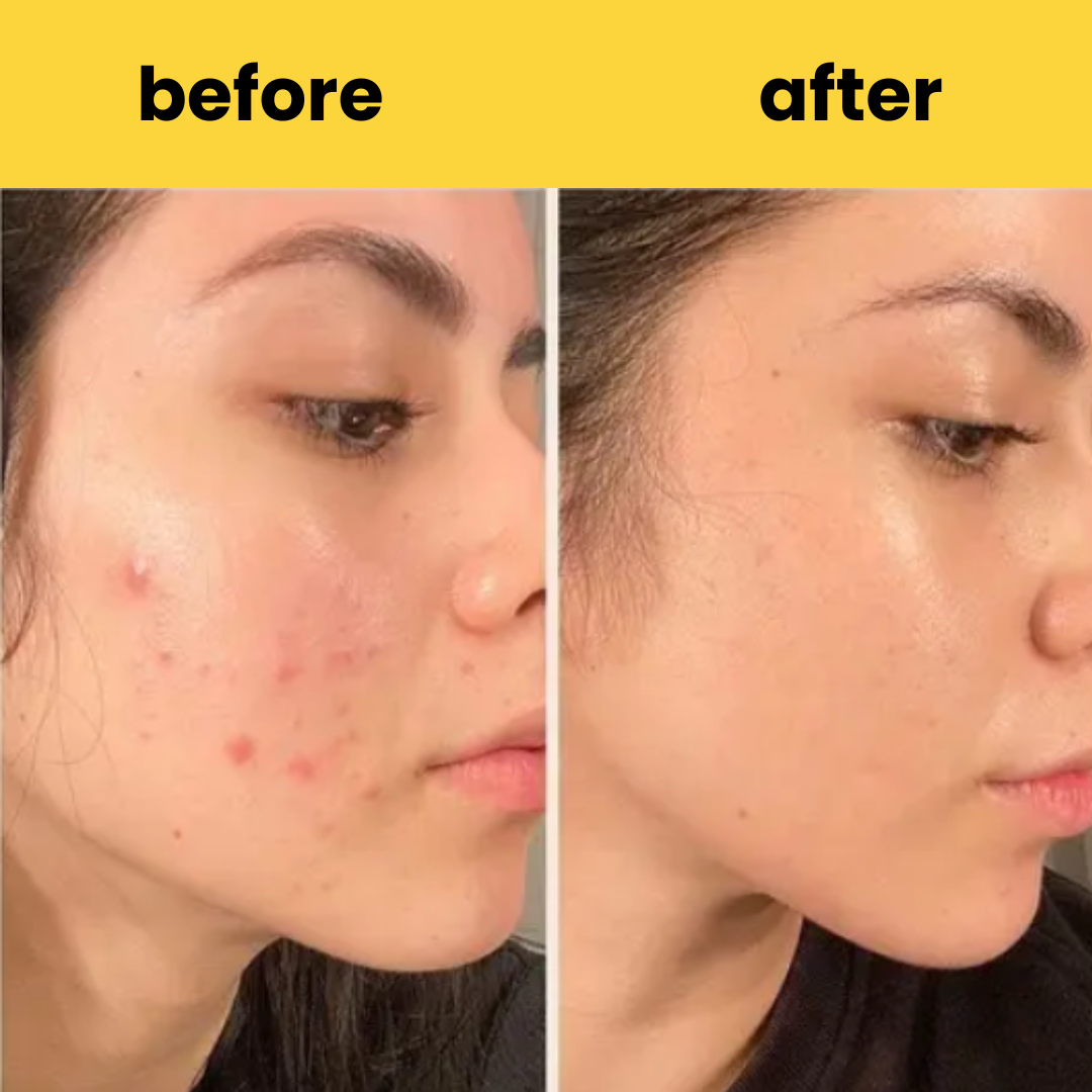 HORIZONLUX™ Turmeric Kojic Acid Pads (60 Pads)