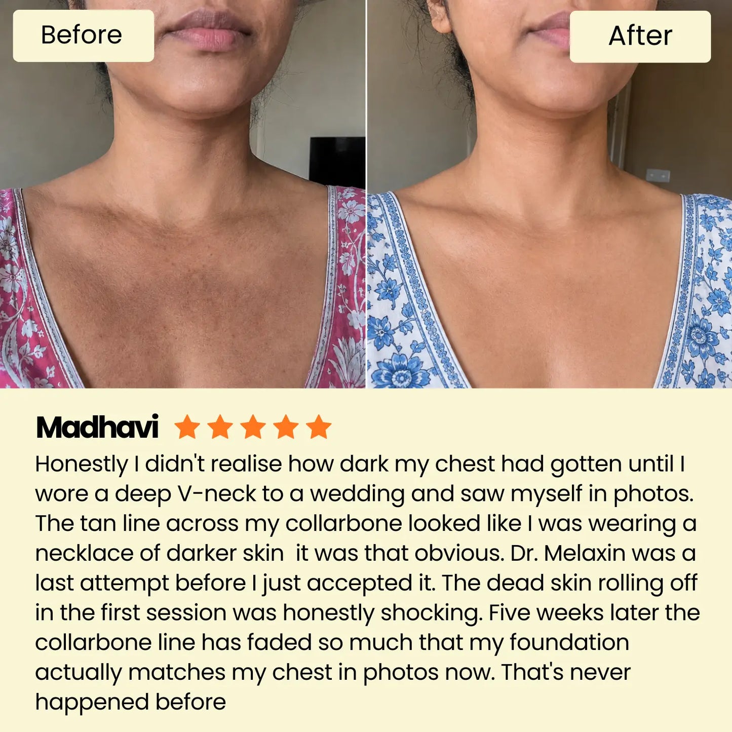 Dr. Melaxin Peel Shot Brightening Body Spray