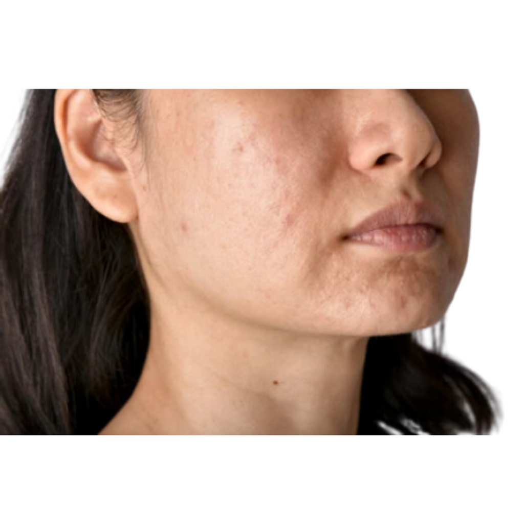 Before using Cleansing Pads