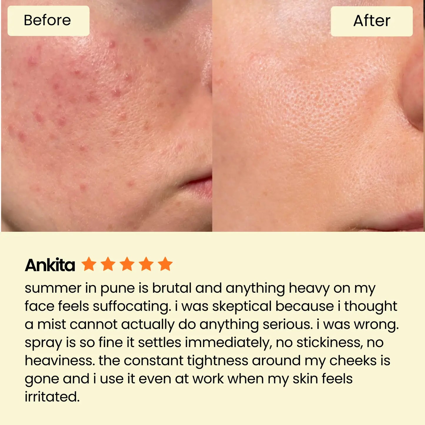 Dr. Althea 345 Relief Cream Mist