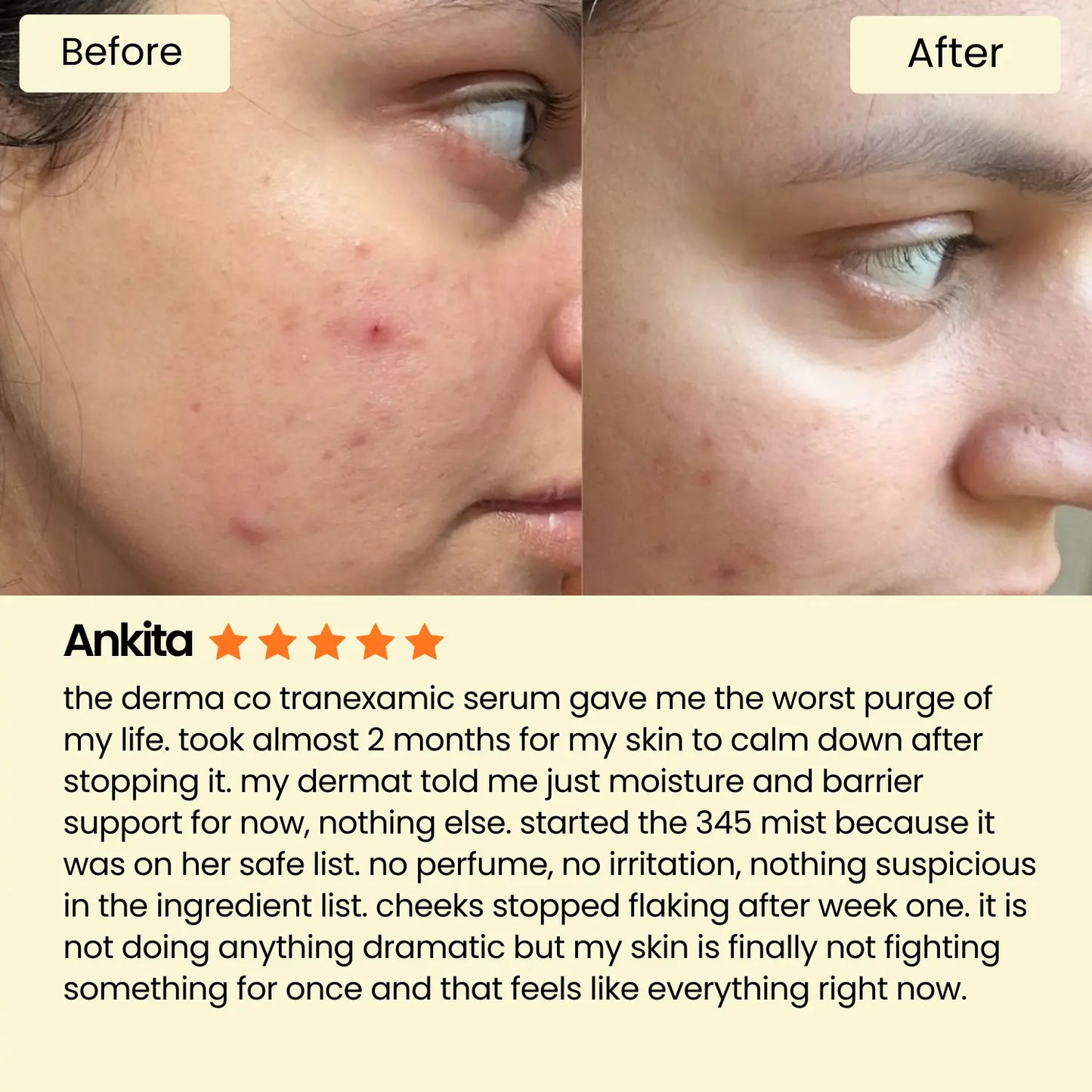 Dr. Althea 345 Relief Cream Mist