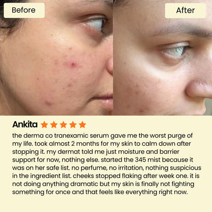 Dr. Althea 345 Relief Cream Mist