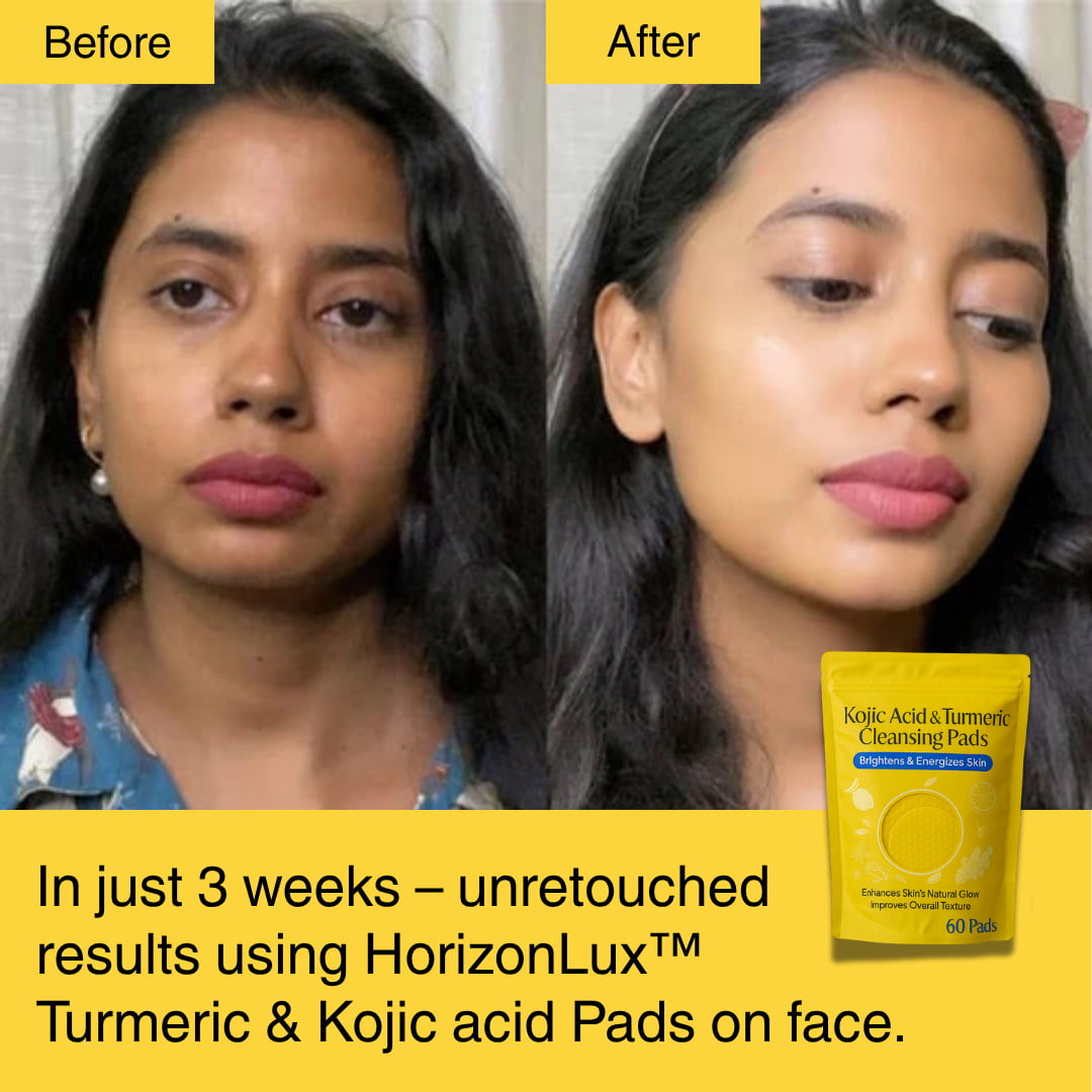 HORIZONLUX™ Turmeric Kojic Acid Pads (60 Pads)