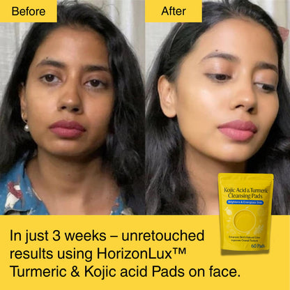 HORIZONLUX™ Turmeric Kojic Acid Pads (60 Pads)