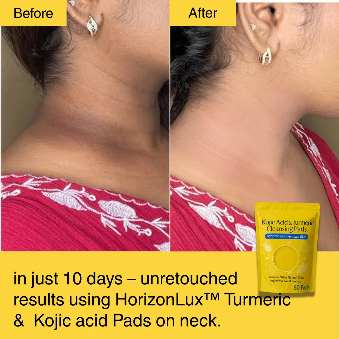 HORIZONLUX™ Turmeric Kojic Acid Pads (60 Pads)