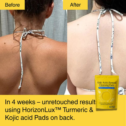 HORIZONLUX™ Turmeric Kojic Acid Pads (60 Pads)