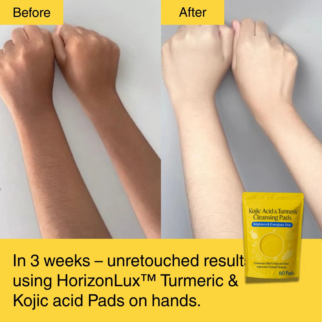 HORIZONLUX™ Turmeric Kojic Acid Pads (60 Pads)