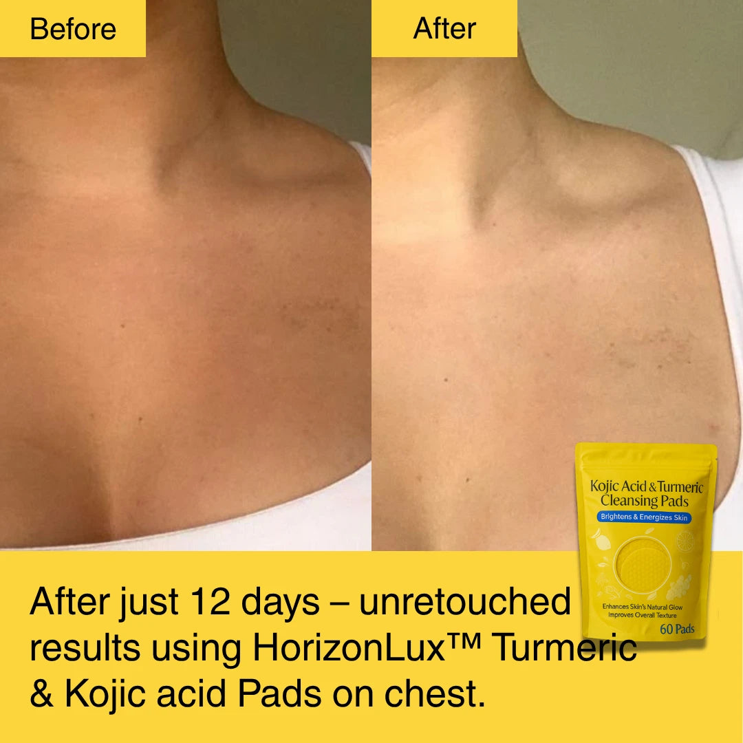 HORIZONLUX™ Turmeric Kojic Acid Pads (60 Pads)