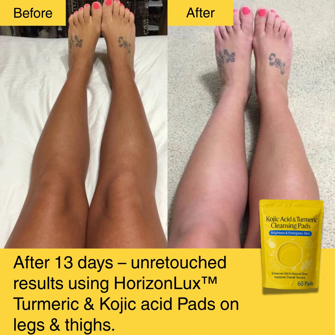 HORIZONLUX™ Turmeric Kojic Acid Pads (60 Pads)