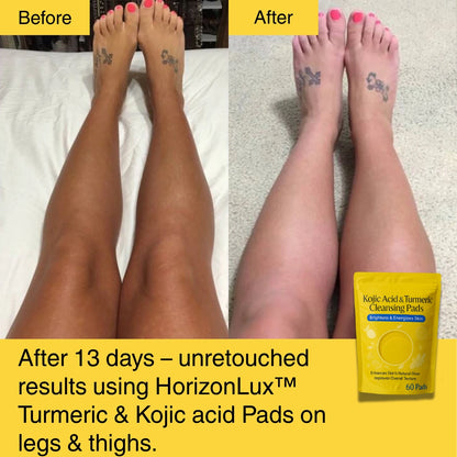 HORIZONLUX™ Turmeric Kojic Acid Pads (60 Pads)