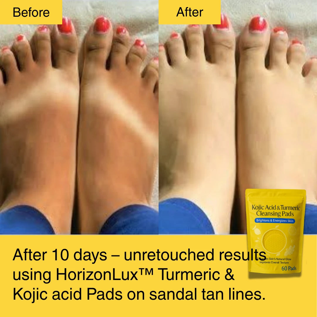 HORIZONLUX™ Turmeric Kojic Acid Pads (60 Pads)