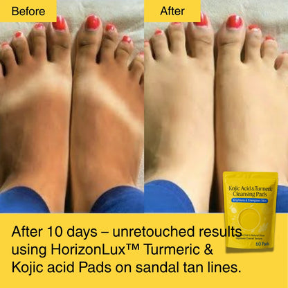 HORIZONLUX™ Turmeric Kojic Acid Pads (60 Pads)