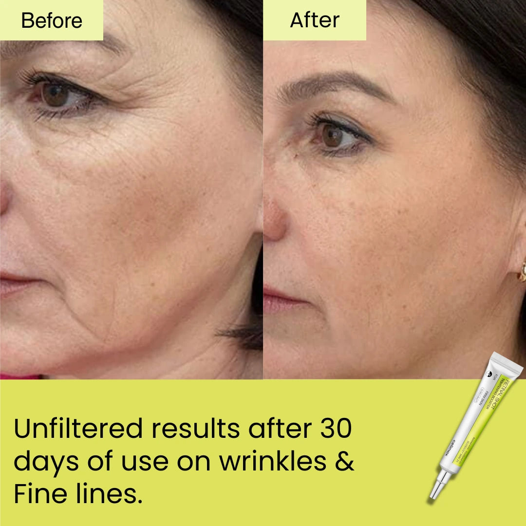 HORIZONLUX™ Retinal Shot Tightening Booster