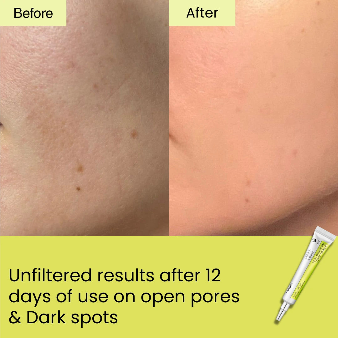 HORIZONLUX™ Retinal Shot Tightening Booster