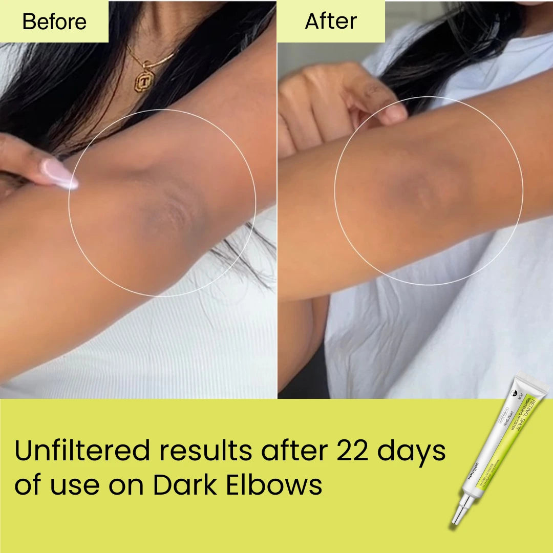 HORIZONLUX™ Retinal Shot Tightening Booster