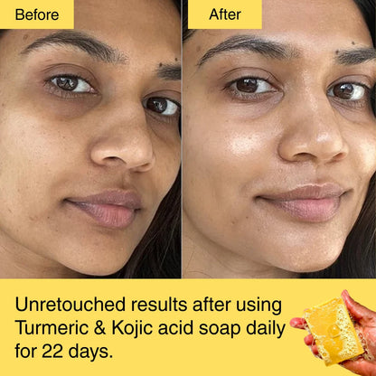 HORIZONLUX™ Turmeric & Kojic Acid Soap