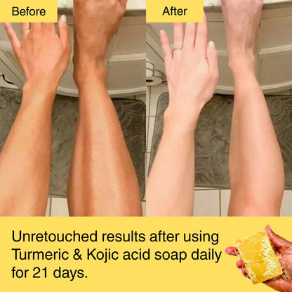 HORIZONLUX™ Turmeric & Kojic Acid Soap