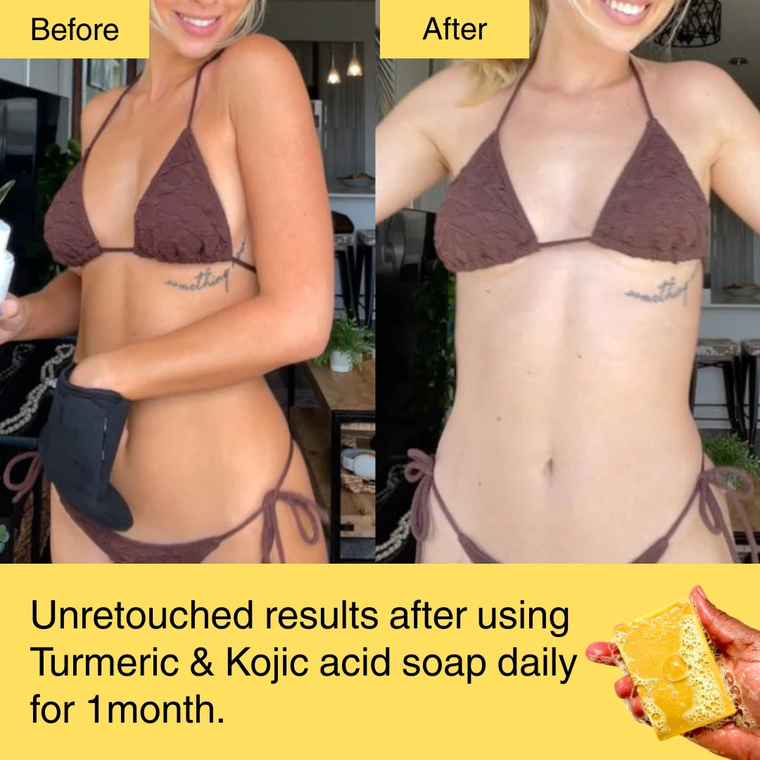 HORIZONLUX™ Turmeric & Kojic Acid Soap