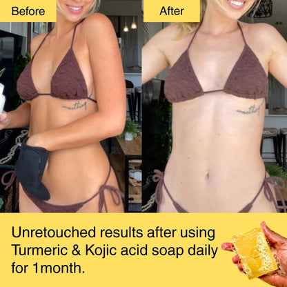 HORIZONLUX™ Turmeric & Kojic Acid Soap