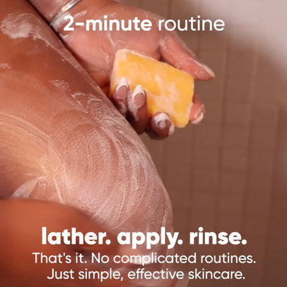 HORIZONLUX™ Turmeric & Kojic Acid Soap